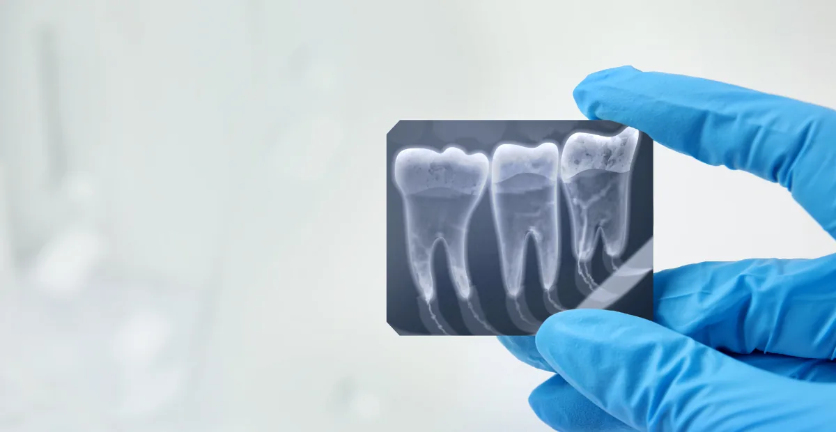 Radiografias Dentárias